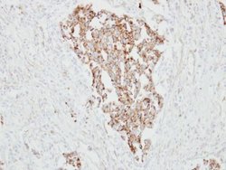 Invitrogen RARRES1 Polyclonal Antibody 100 &mu;L; Unconjugated:Antibodies,