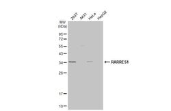 Invitrogen RARRES1 Polyclonal Antibody 100 &mu;L; Unconjugated:Antibodies,