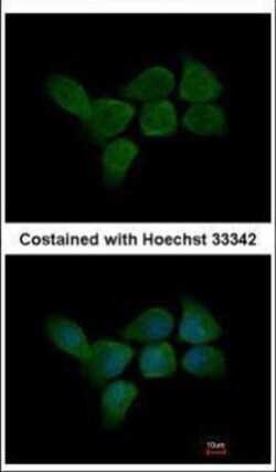 Invitrogen CALML3 Polyclonal Antibody 100 &mu;L; Unconjugated:Antibodies,