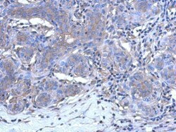 Invitrogen CALML3 Polyclonal Antibody 100 &mu;L; Unconjugated:Antibodies,