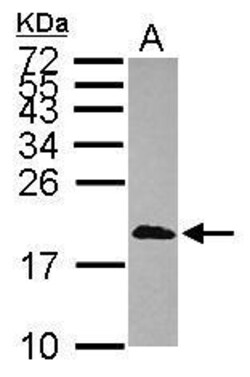 Invitrogen CALML3 Polyclonal Antibody 100 &mu;L; Unconjugated:Antibodies,