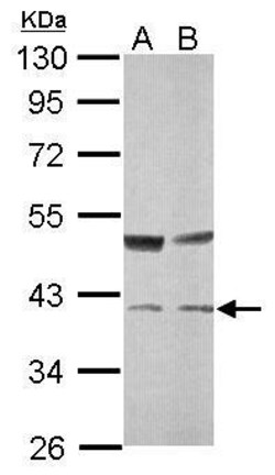 Invitrogen TALDO1 Polyclonal Antibody 100 &mu;L; Unconjugated:Antibodies,