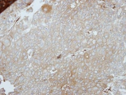 Invitrogen LIMS1 Polyclonal Antibody 100 &mu;L; Unconjugated:Antibodies,