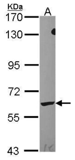 Invitrogen LTA4H Polyclonal Antibody 100 μL; Unconjugated:Antibodies,