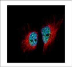 Invitrogen hnRNP M Polyclonal Antibody 100 &mu;L | Buy Online | Invitrogen&trade; | Fisher Scientific