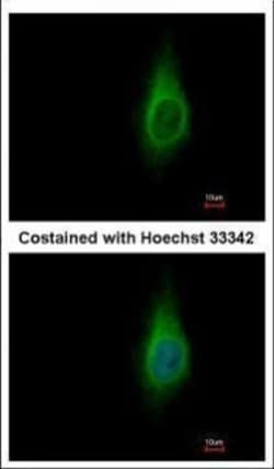Invitrogen IMPA1 Polyclonal Antibody 100 &mu;L; Unconjugated:Antibodies,