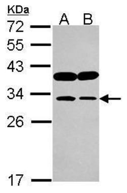 Invitrogen IMPA1 Polyclonal Antibody 100 &mu;L; Unconjugated:Antibodies,