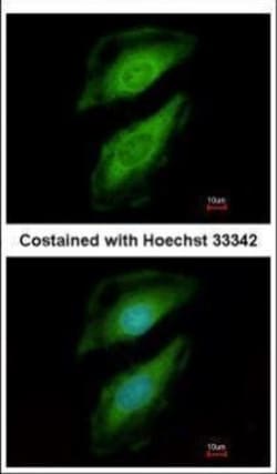Invitrogen PLCD1 Polyclonal Antibody 100 &mu;L; Unconjugated:Antibodies,