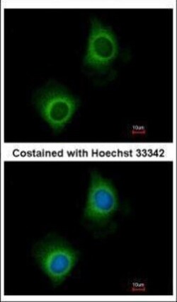 Invitrogen VARS Polyclonal Antibody 100 μL; Unconjugated:Antibodies,