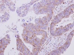 Invitrogen VARS Polyclonal Antibody 100 μL; Unconjugated:Antibodies,