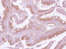 Invitrogen COX15 Polyclonal Antibody 100 &mu;L; Unconjugated:Antibodies,