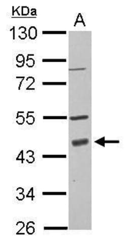 Invitrogen PDCD2 Polyclonal Antibody 100 &mu;L; Unconjugated:Antibodies,