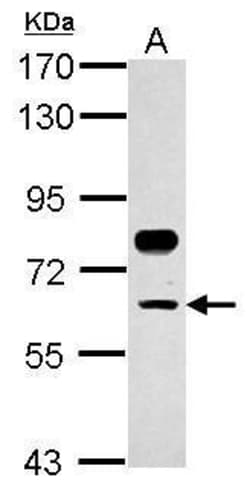 Invitrogen TFCP2 Polyclonal Antibody 100 &mu;L; Unconjugated:Antibodies,