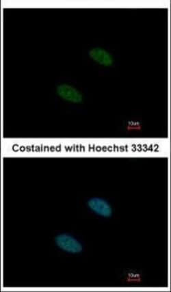 Invitrogen SF3A2 Polyclonal Antibody 100 μL; Unconjugated:Antibodies,
