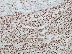 Invitrogen SF3A2 Polyclonal Antibody 100 μL; Unconjugated:Antibodies,