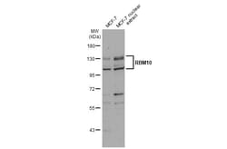 Invitrogen RBM10 Polyclonal Antibody 100 &mu;L; Unconjugated:Antibodies,