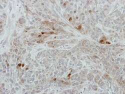 Invitrogen RANBP3 Polyclonal Antibody 100 &mu;L | Buy Online | Invitrogen&trade; | Fisher Scientific