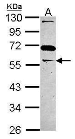 Invitrogen GAS7 Polyclonal Antibody 100 &mu;L | Buy Online | Invitrogen&trade; | Fisher Scientific