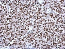 Invitrogen CGGBP1 Polyclonal Antibody 100 &mu;L; Unconjugated:Antibodies,