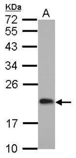Invitrogen CGGBP1 Polyclonal Antibody 100 &mu;L; Unconjugated:Antibodies,