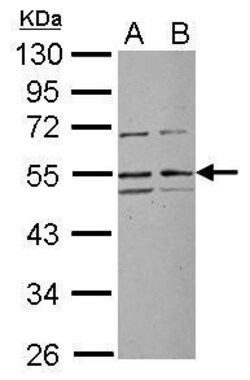 Invitrogen RRP1 Polyclonal Antibody 100 &mu;L; Unconjugated:Antibodies,