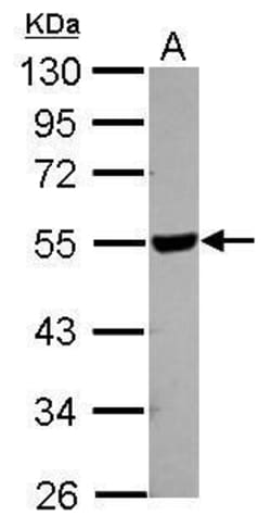Invitrogen HYAL2 Polyclonal Antibody 100 &mu;L; Unconjugated:Antibodies,