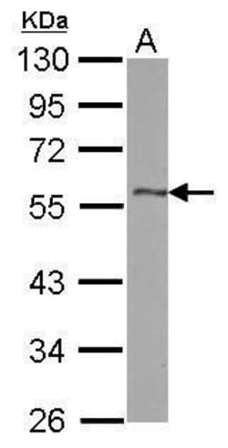 Invitrogen DLK1 Polyclonal Antibody 100 &mu;L | Buy Online | Invitrogen&trade; | Fisher Scientific