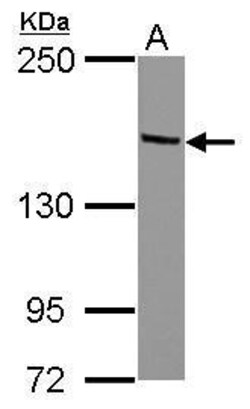 TRIM24 Polyclonal Antibody, Invitrogen 100 &mu;L; Unconjugated:Antibodies,