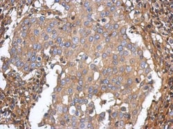 Invitrogen ST3GAL5 Polyclonal Antibody 100 &mu;L; Unconjugated:Antibodies,