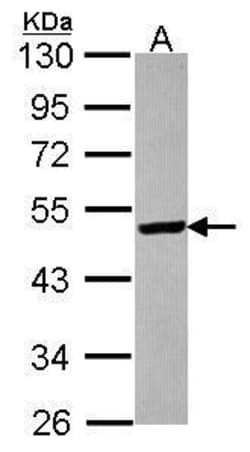 Invitrogen ST3GAL5 Polyclonal Antibody 100 &mu;L; Unconjugated:Antibodies,
