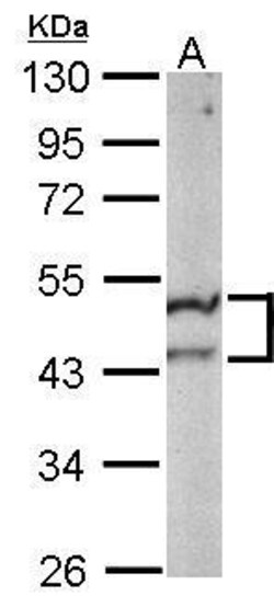 Invitrogen ST3GAL5 Polyclonal Antibody 100 &mu;L; Unconjugated:Antibodies,