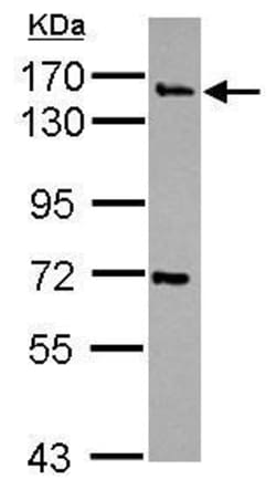 Invitrogen Synaptojanin 2 Polyclonal Antibody 100 μL; Unconjugated:Antibodies,