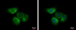 Invitrogen EIF2B4 Polyclonal Antibody 100 &mu;L; Unconjugated:Antibodies,