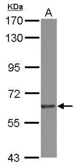 Invitrogen EIF2B4 Polyclonal Antibody 100 &mu;L; Unconjugated:Antibodies,