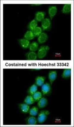 Invitrogen PRC1 Polyclonal Antibody 100 &mu;L | Buy Online | Invitrogen&trade; | Fisher Scientific