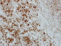 Invitrogen PRC1 Polyclonal Antibody 100 &mu;L | Buy Online | Invitrogen&trade; | Fisher Scientific