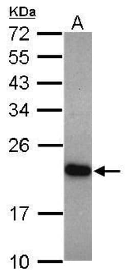 Invitrogen UNC119 Polyclonal Antibody 100 &mu;L; Unconjugated:Anticuerpos