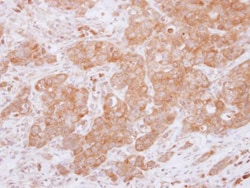Invitrogen USP14 Polyclonal Antibody 100 &mu;L; Unconjugated:Antibodies,