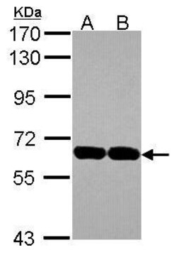Invitrogen USP14 Polyclonal Antibody 100 &mu;L; Unconjugated:Antibodies,