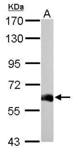 Invitrogen USP14 Polyclonal Antibody 100 &mu;L; Unconjugated:Antibodies,