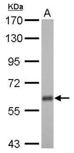Invitrogen USP14 Polyclonal Antibody 100 &mu;L; Unconjugated:Antibodies,