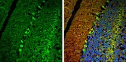 Invitrogen USP14 Polyclonal Antibody 100 &mu;L; Unconjugated:Antibodies,