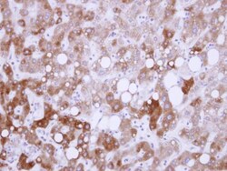 Invitrogen USP14 Polyclonal Antibody 100 &mu;L; Unconjugated:Antibodies,