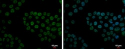 Invitrogen FCP1 Polyclonal Antibody 100 &mu;L; Unconjugated:Antibodies,