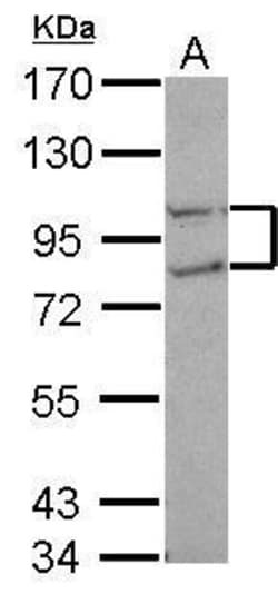 Invitrogen FCP1 Polyclonal Antibody 100 &mu;L; Unconjugated:Antibodies,