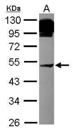 Invitrogen AP4M1 Polyclonal Antibody 100 &mu;L | Buy Online | Invitrogen&trade; | Fisher Scientific
