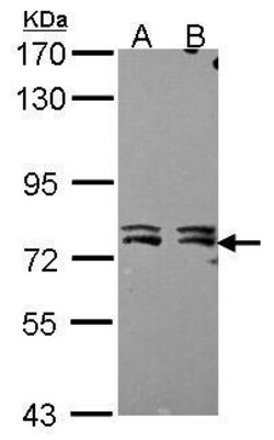 Invitrogen MTA2 Polyclonal Antibody 100 &mu;L; Unconjugated:Antibodies,