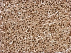 Invitrogen BCL7C Polyclonal Antibody 100 &mu;L; Unconjugated:Antibodies,