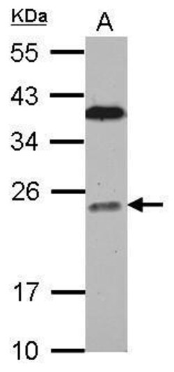 Invitrogen BCL7C Polyclonal Antibody 100 &mu;L; Unconjugated:Antibodies,