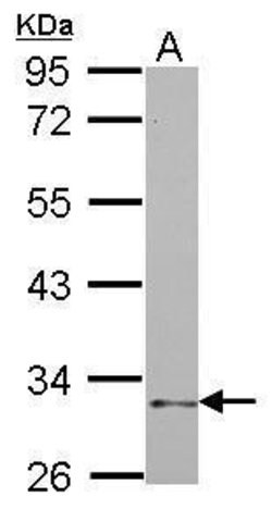 NKp46 Polyclonal Antibody, Invitrogen 100 &mu;L; Unconjugated:Antibodies,